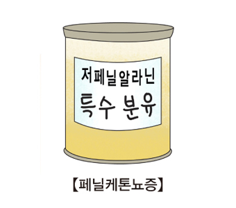 페닐케톤뇨증